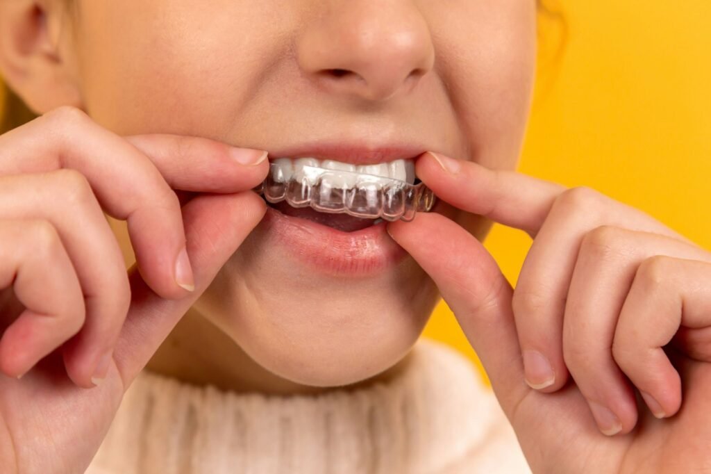 Clear Invisalign aligner held up before orthodontic treatment in Dubai
